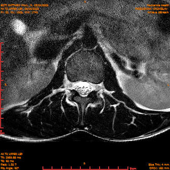 2025-06-09/AX T2 UPPER LSP/0023-IM184.png