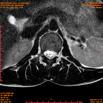 2025-06-09/AX T2 UPPER LSP/0024-IM185.png