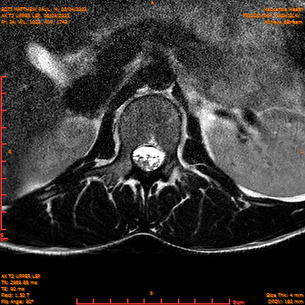 2025-06-09/AX T2 UPPER LSP/0025-IM186.png