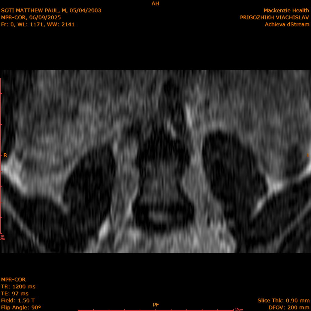 2025-06-09/MPR-COR/0001-.png