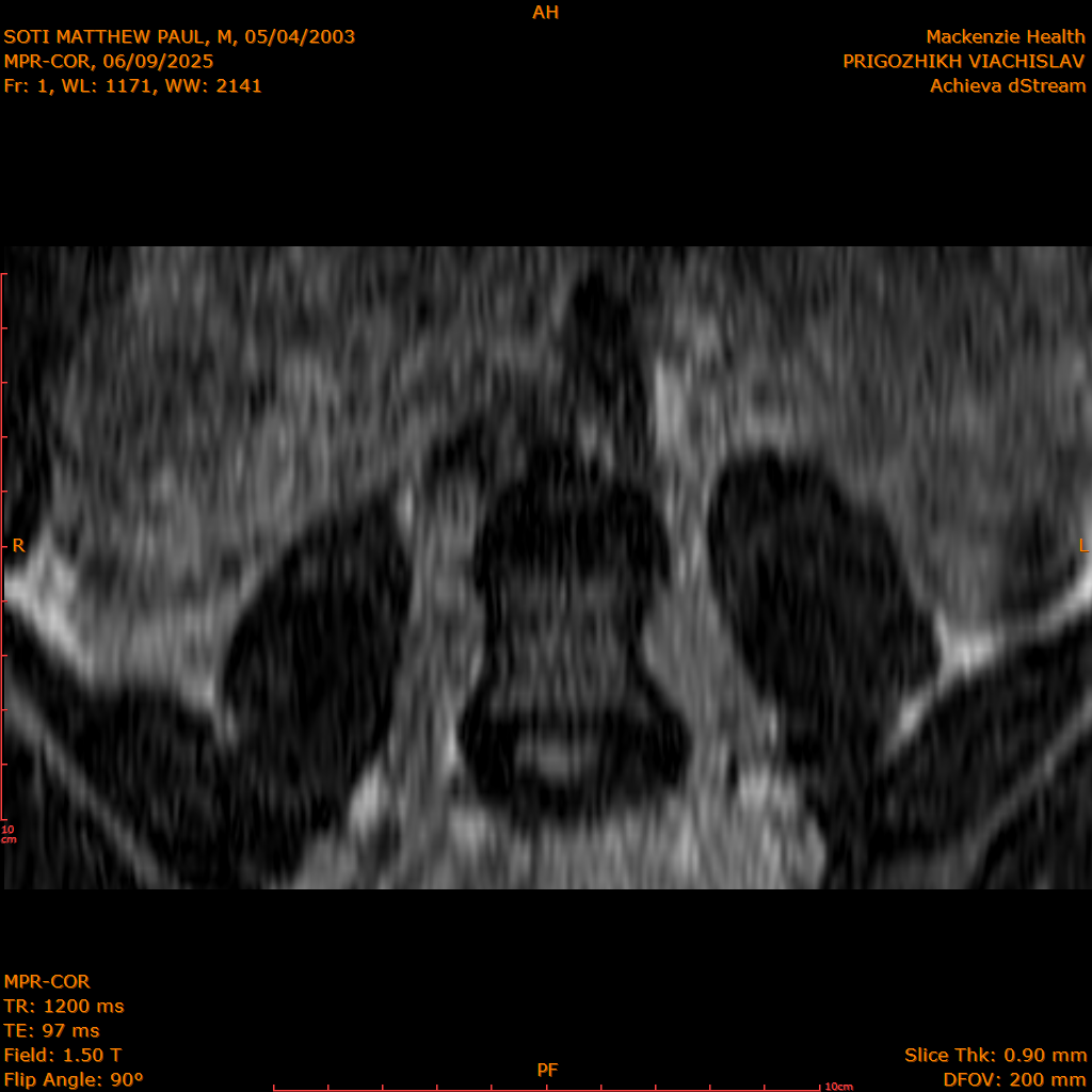 2025-06-09/MPR-COR/0002-.png