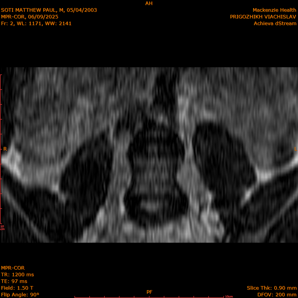 2025-06-09/MPR-COR/0003-.png