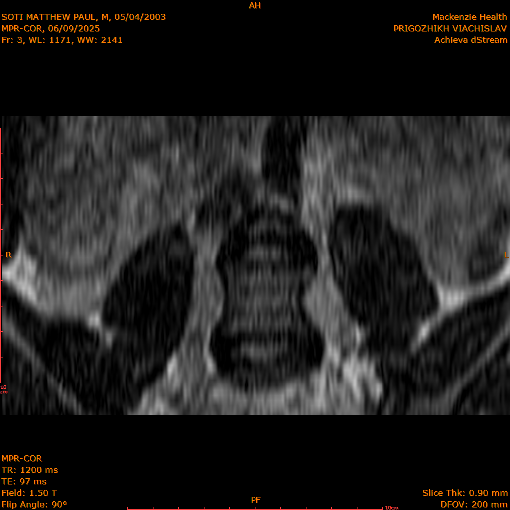2025-06-09/MPR-COR/0004-.png