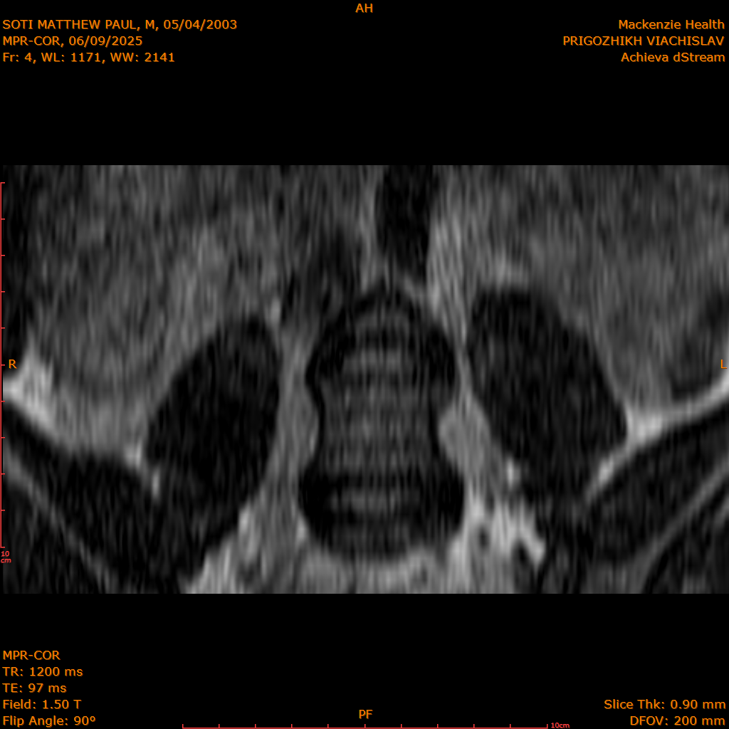 2025-06-09/MPR-COR/0005-.png