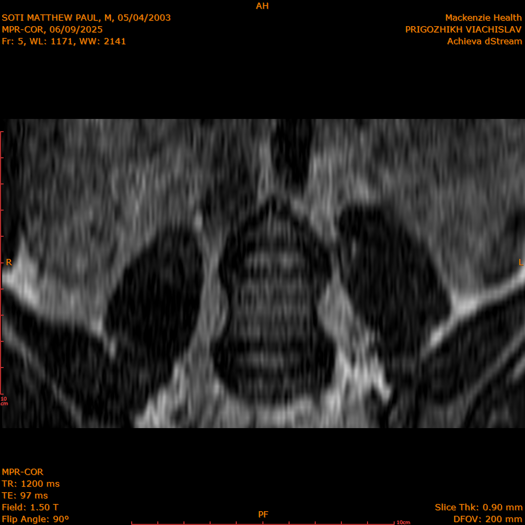 2025-06-09/MPR-COR/0006-.png
