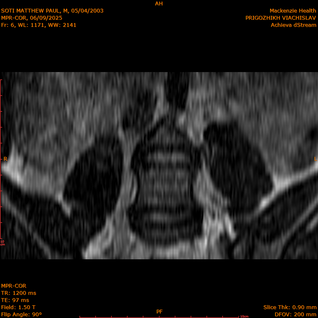 2025-06-09/MPR-COR/0007-.png