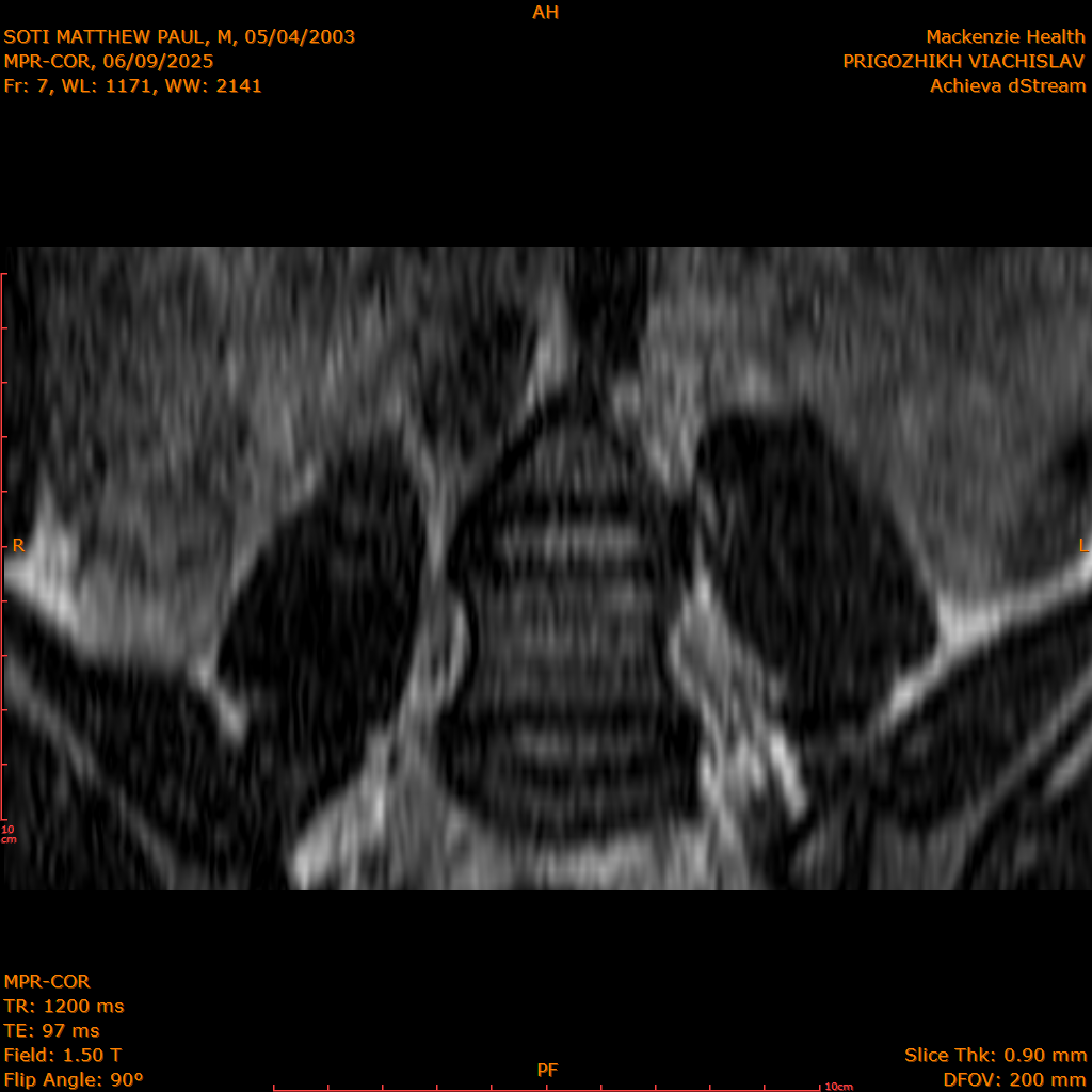 2025-06-09/MPR-COR/0008-.png