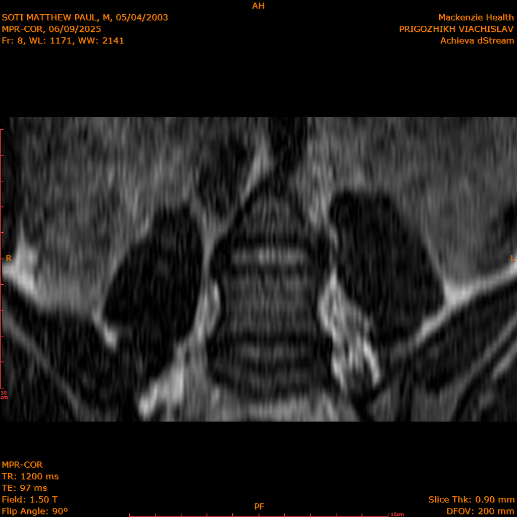 2025-06-09/MPR-COR/0009-.png