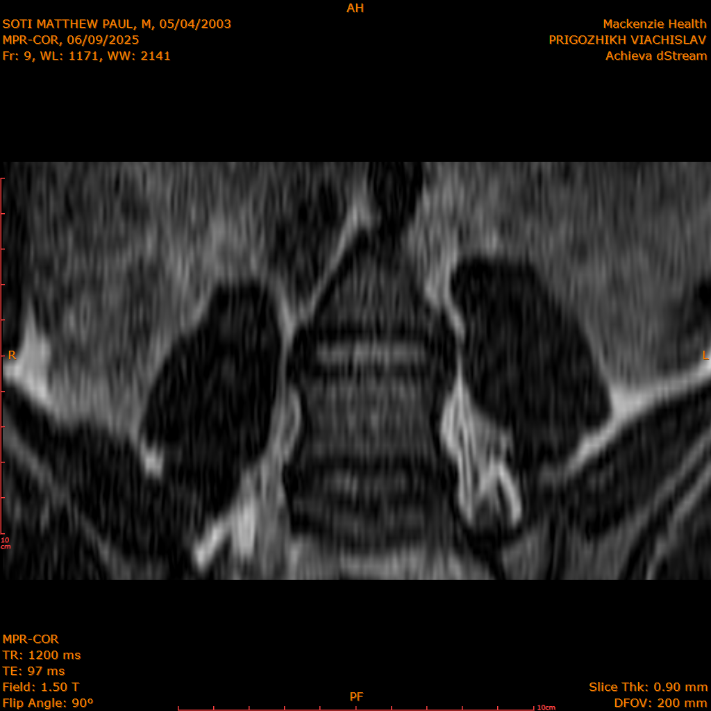 2025-06-09/MPR-COR/0010-.png