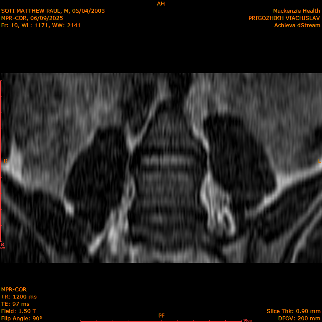 2025-06-09/MPR-COR/0011-.png