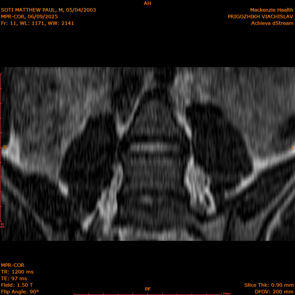 2025-06-09/MPR-COR/0012-.png