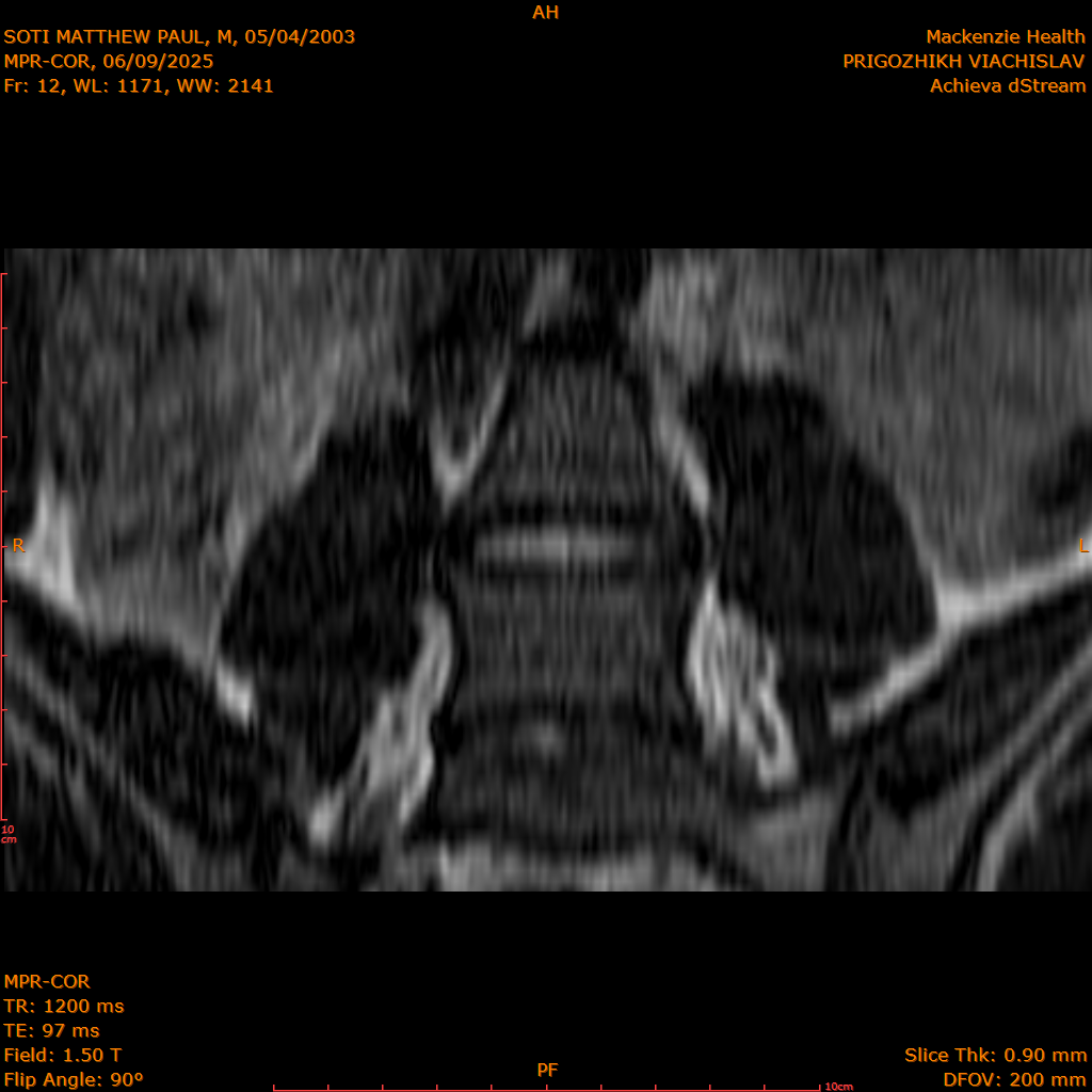 2025-06-09/MPR-COR/0013-.png