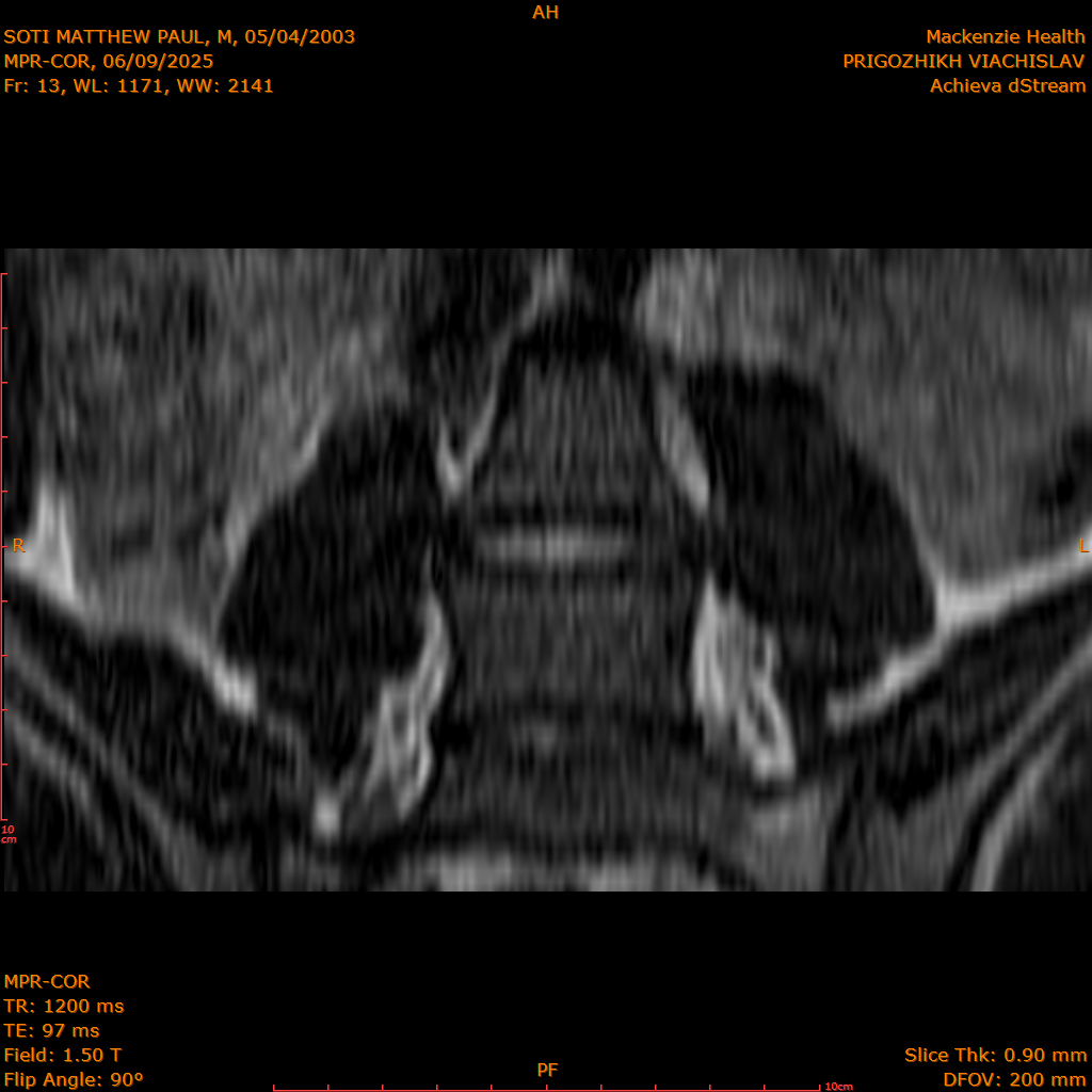 2025-06-09/MPR-COR/0014-.png