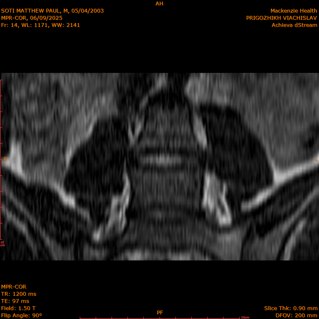 2025-06-09/MPR-COR/0015-.png