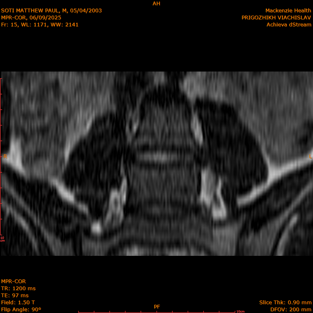 2025-06-09/MPR-COR/0016-.png