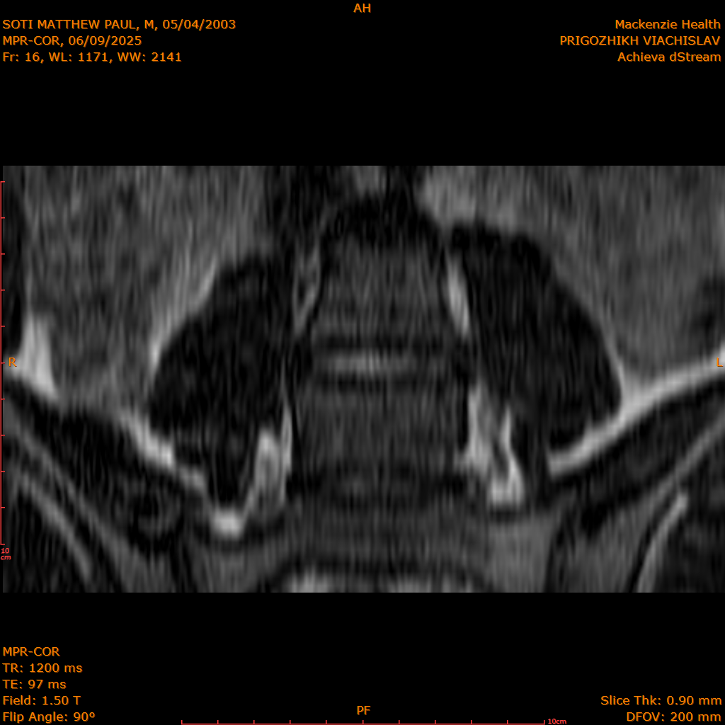 2025-06-09/MPR-COR/0017-.png