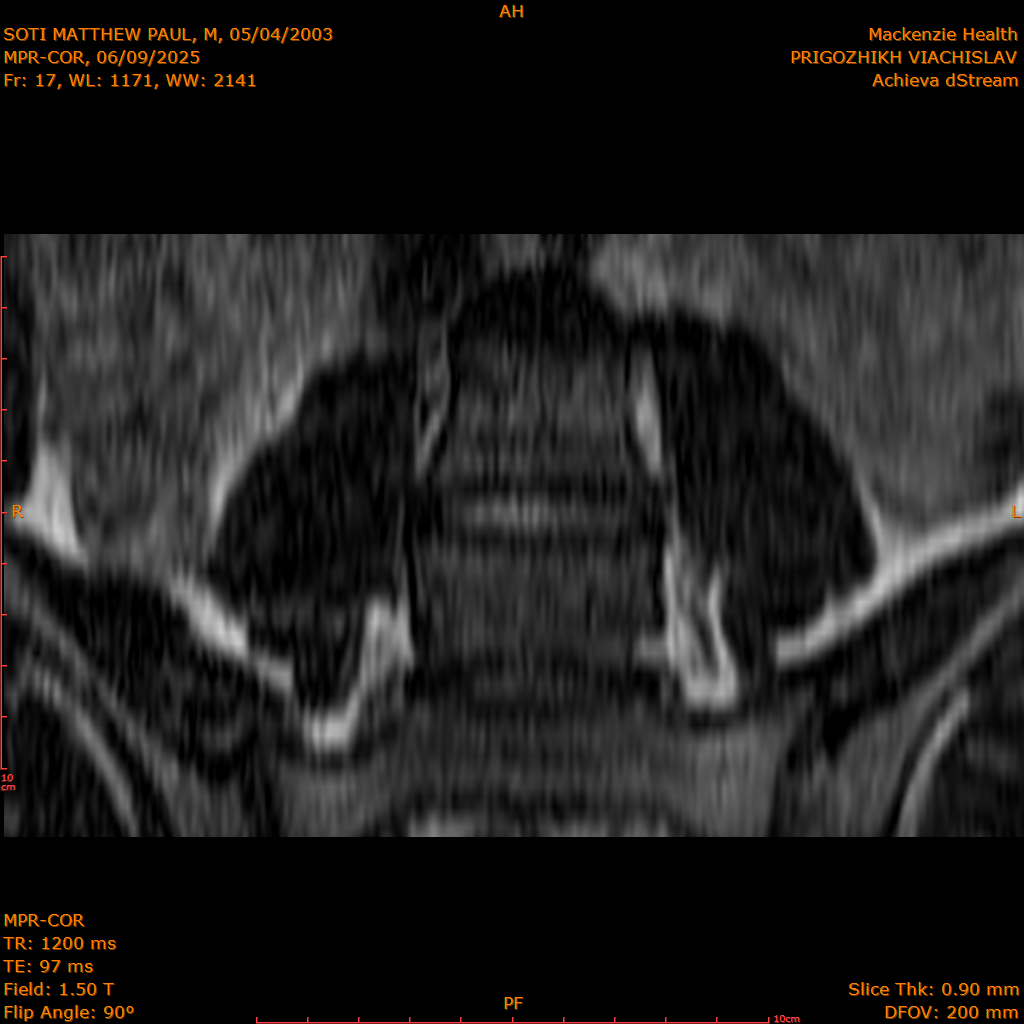 2025-06-09/MPR-COR/0018-.png