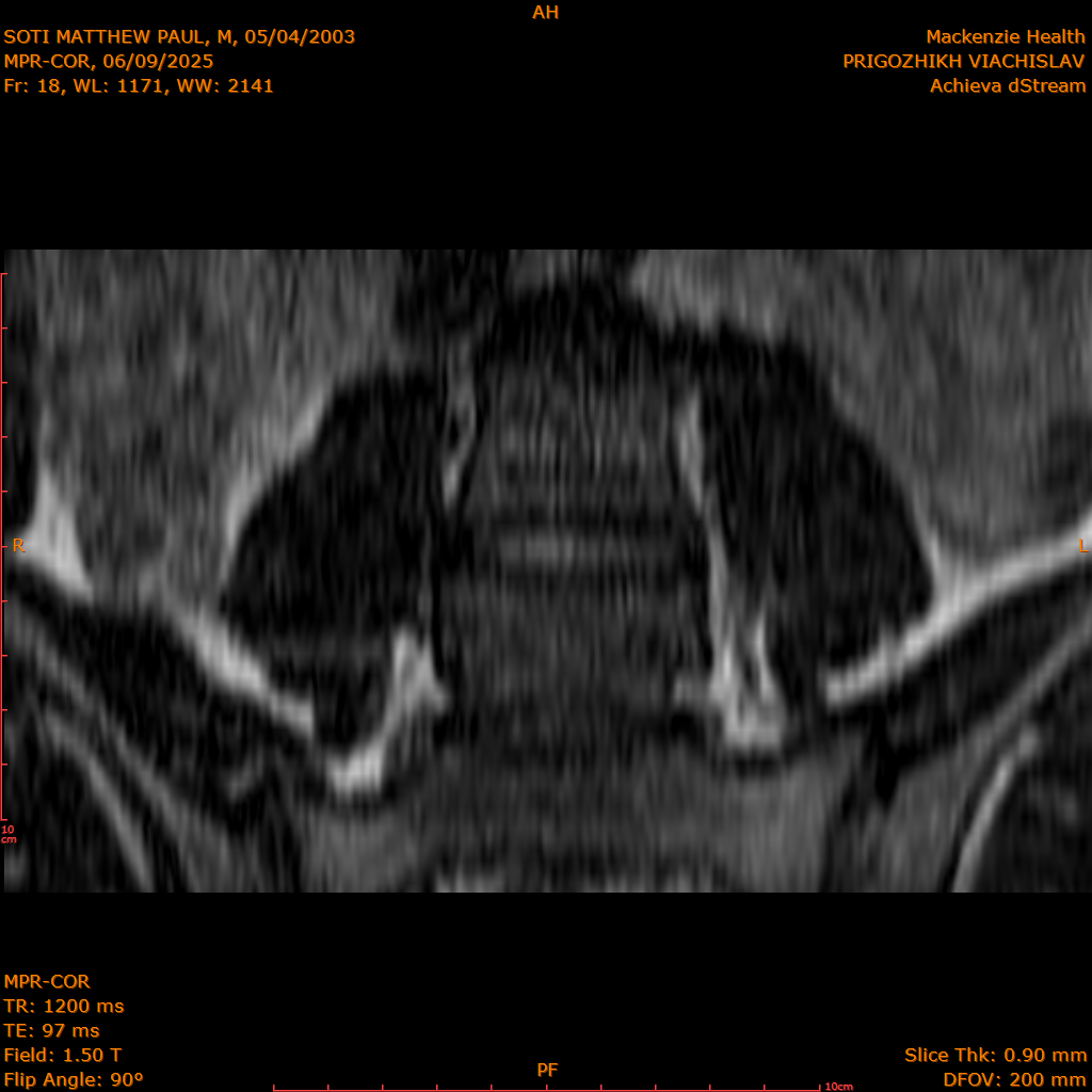 2025-06-09/MPR-COR/0019-.png