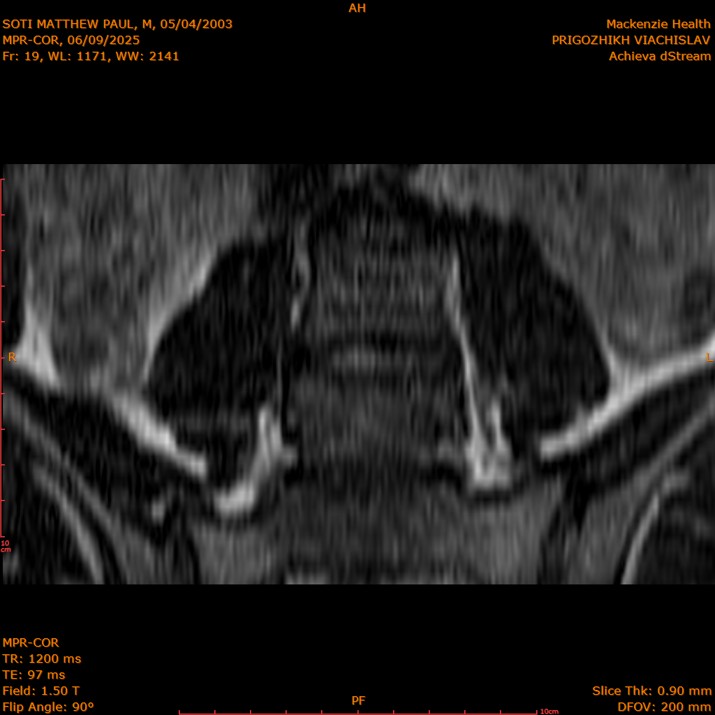 2025-06-09/MPR-COR/0020-.png