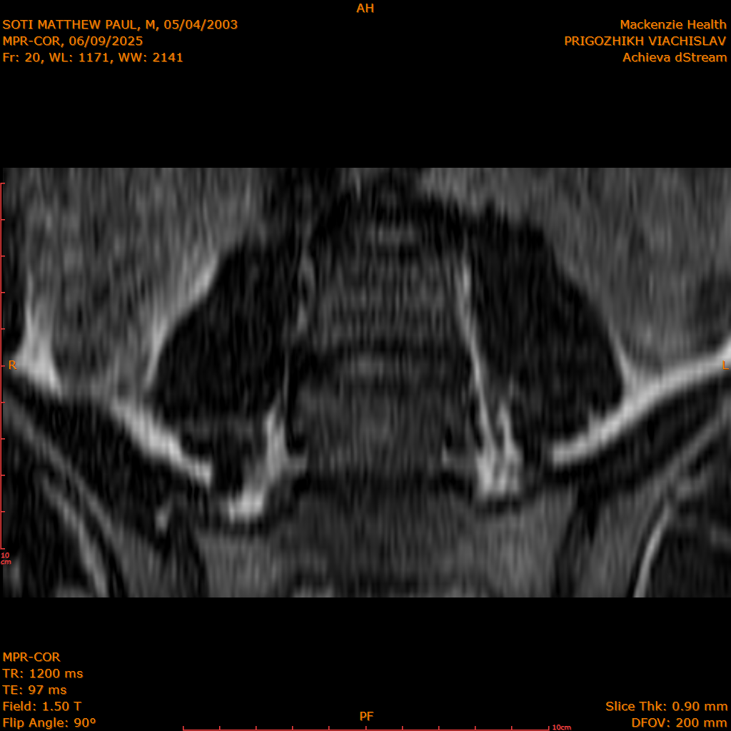 2025-06-09/MPR-COR/0021-.png