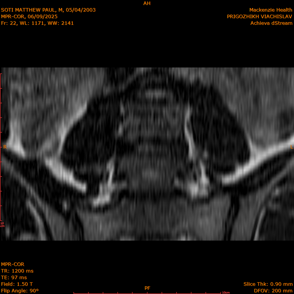 2025-06-09/MPR-COR/0023-.png