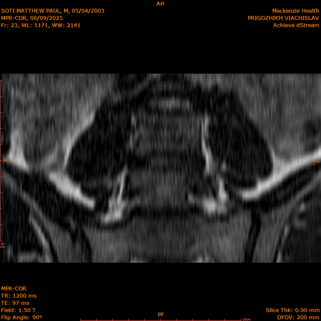2025-06-09/MPR-COR/0024-.png