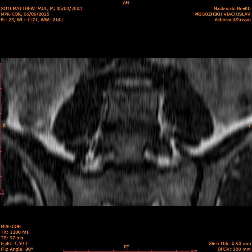 2025-06-09/MPR-COR/0026-.png