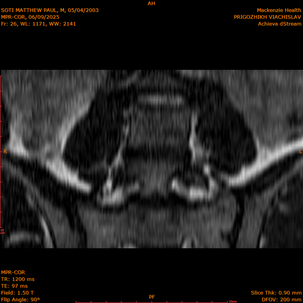 2025-06-09/MPR-COR/0027-.png