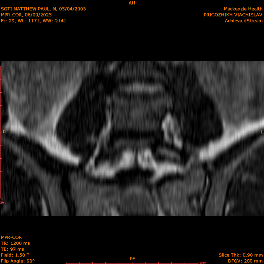 2025-06-09/MPR-COR/0030-.png