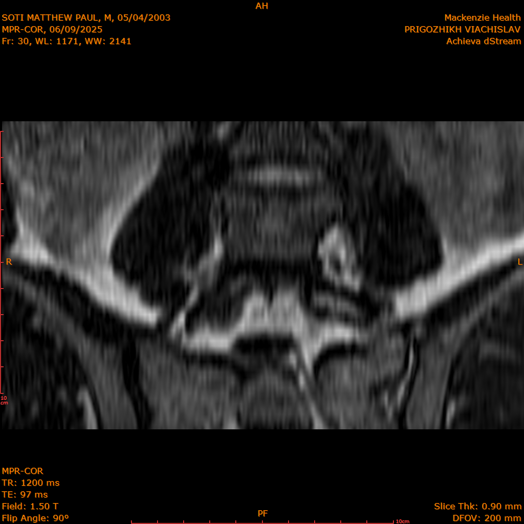 2025-06-09/MPR-COR/0031-.png