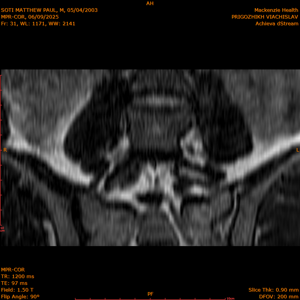 2025-06-09/MPR-COR/0032-.png