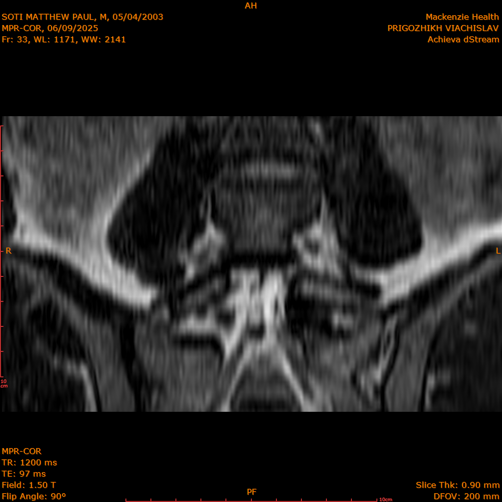 2025-06-09/MPR-COR/0034-.png