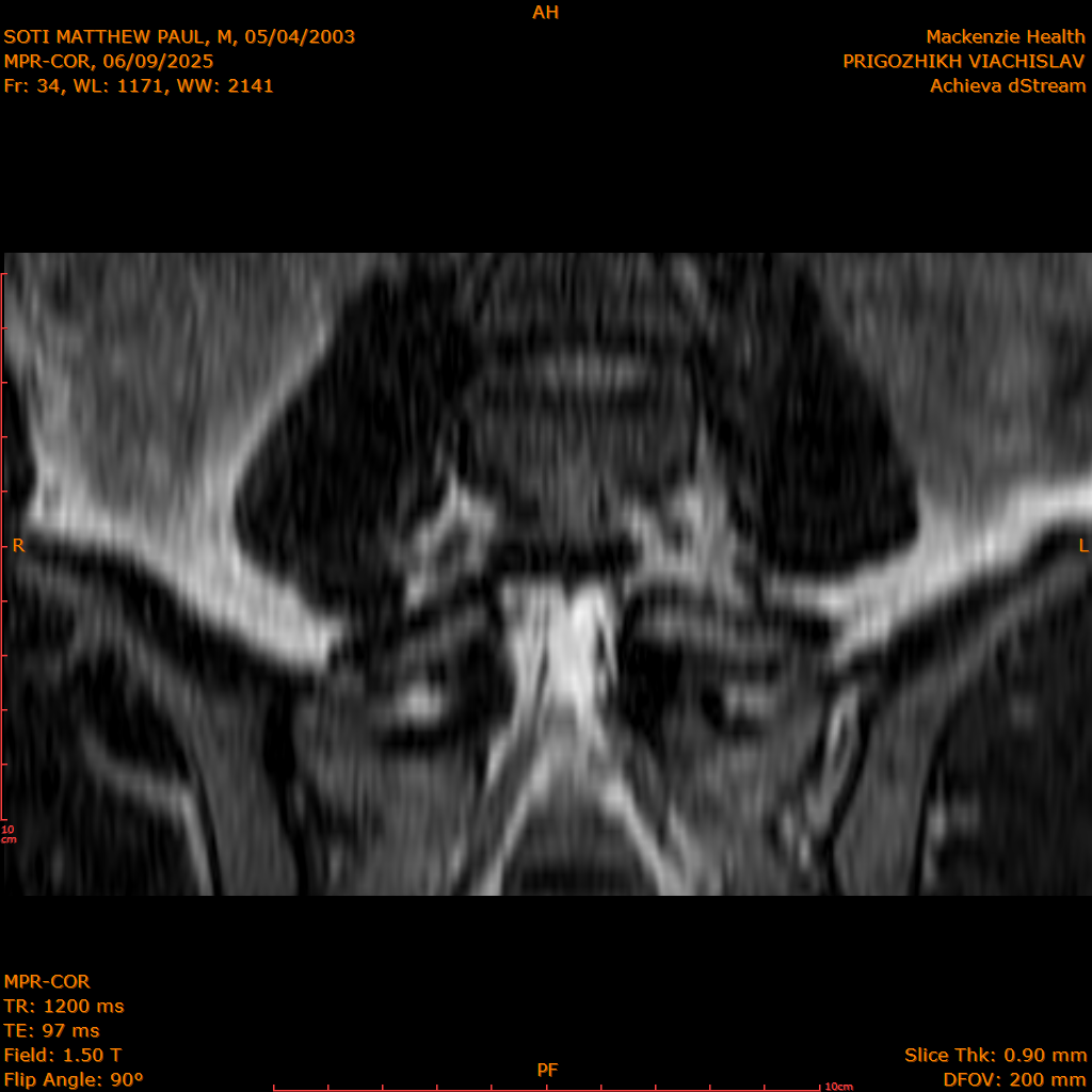 2025-06-09/MPR-COR/0035-.png
