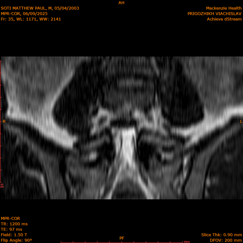 2025-06-09/MPR-COR/0036-.png