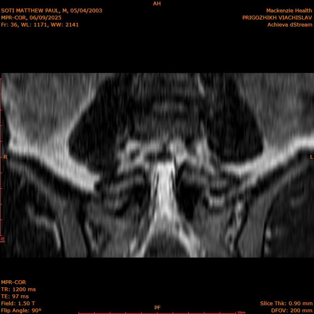 2025-06-09/MPR-COR/0037-.png