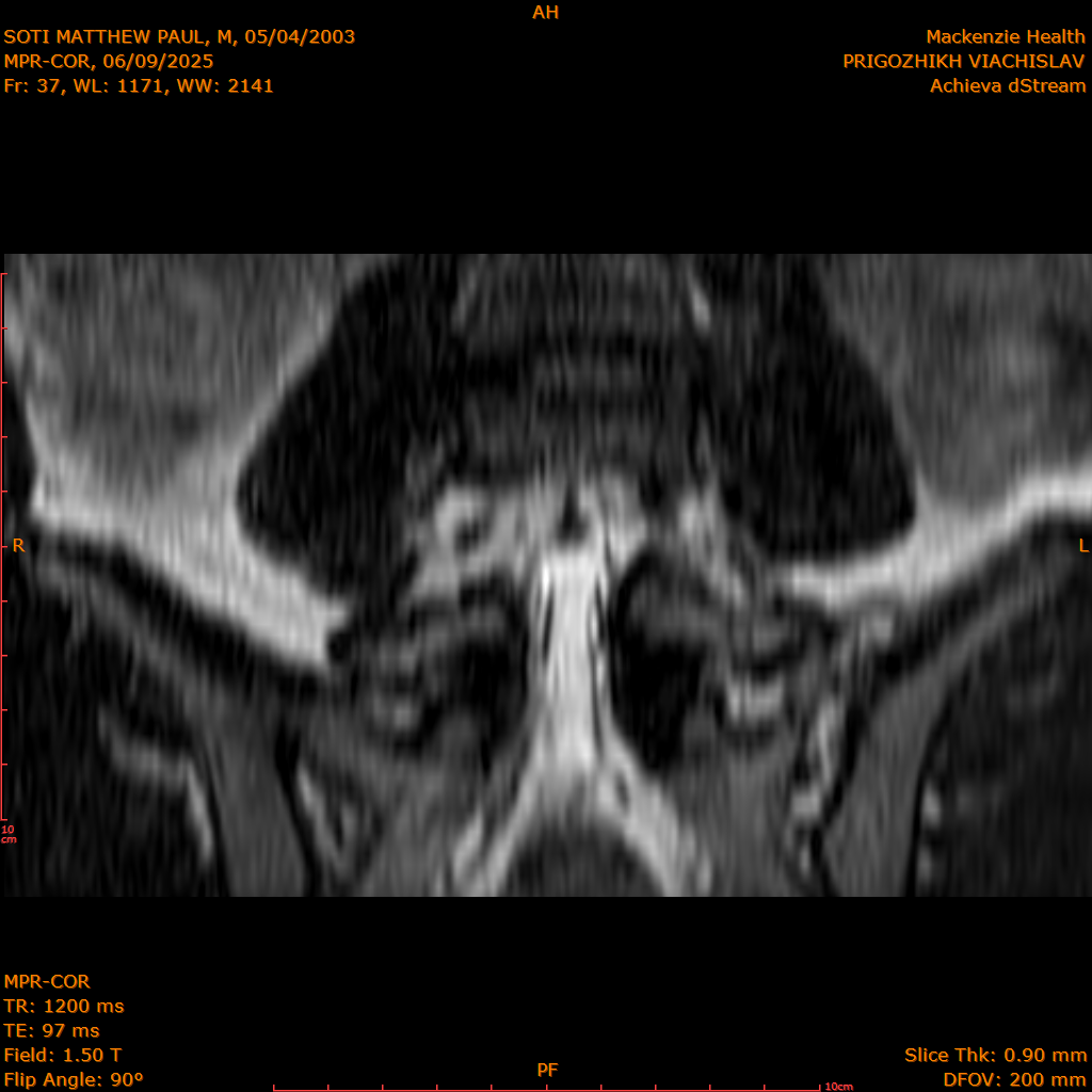 2025-06-09/MPR-COR/0038-.png