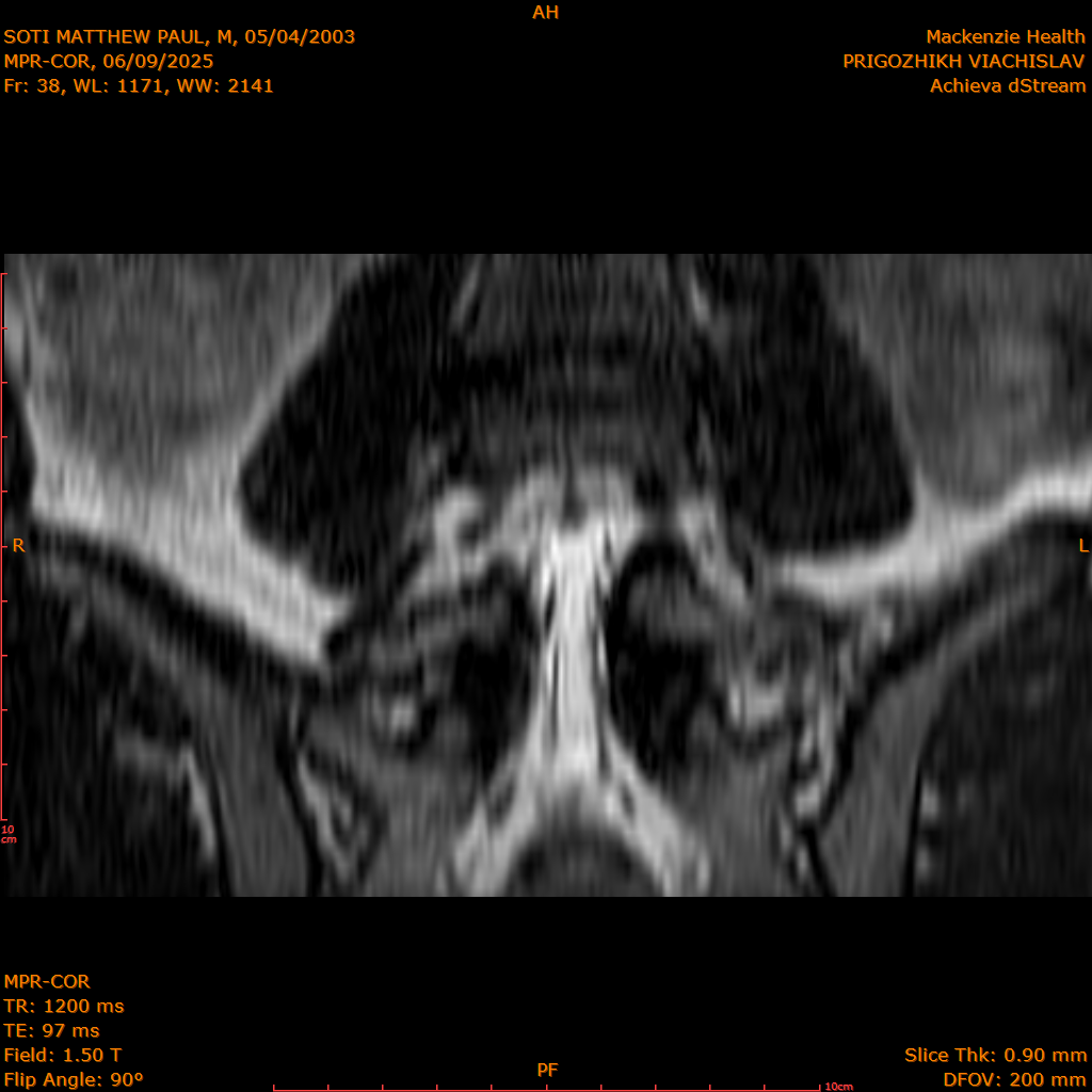 2025-06-09/MPR-COR/0039-IM100.png