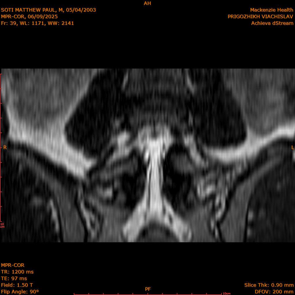 2025-06-09/MPR-COR/0040-IM101.png