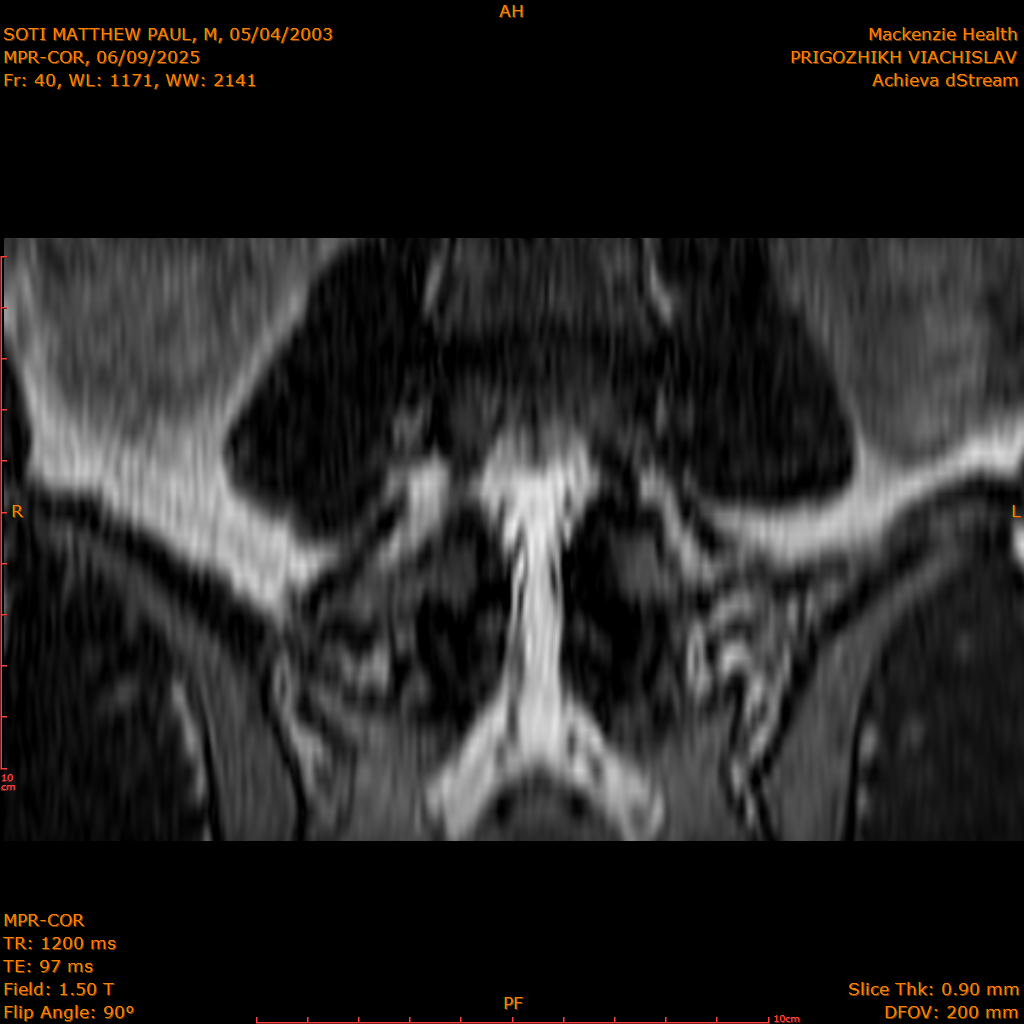 2025-06-09/MPR-COR/0041-IM102.png