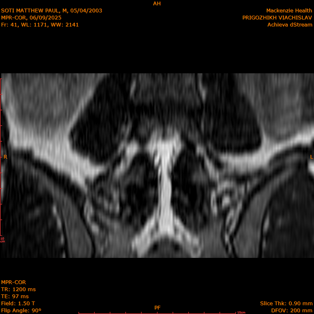 2025-06-09/MPR-COR/0042-IM103.png