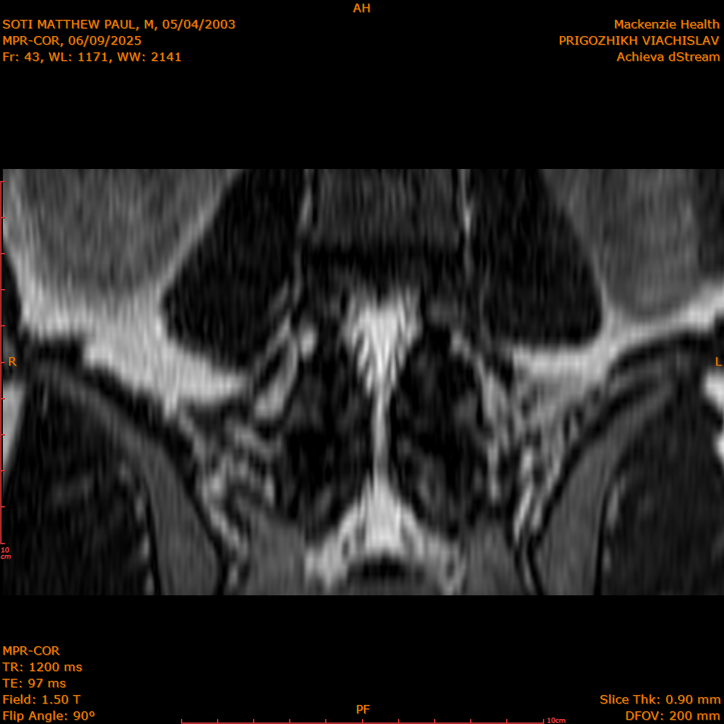 2025-06-09/MPR-COR/0044-IM105.png