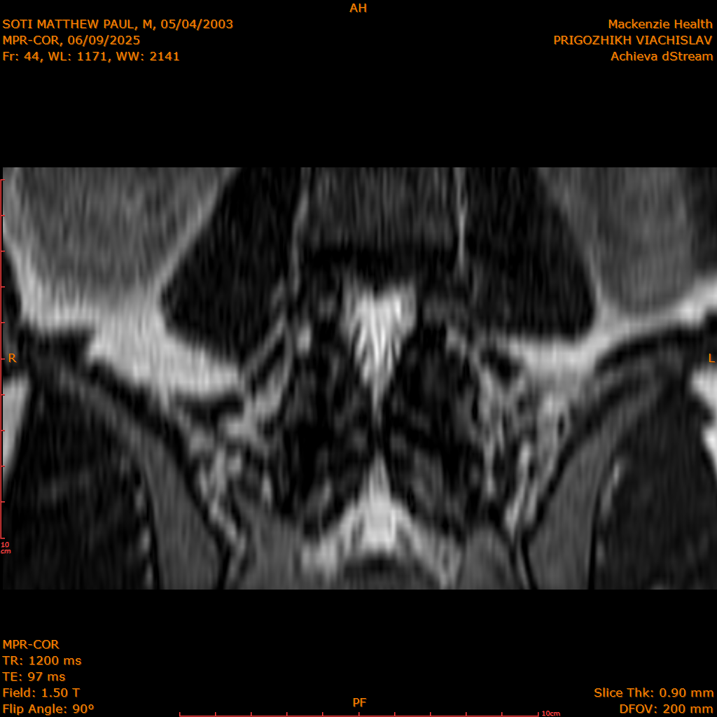 2025-06-09/MPR-COR/0045-IM106.png