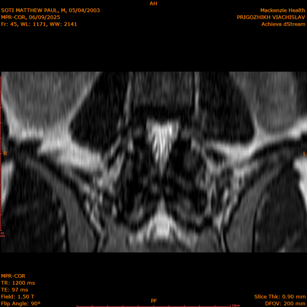 2025-06-09/MPR-COR/0046-IM107.png