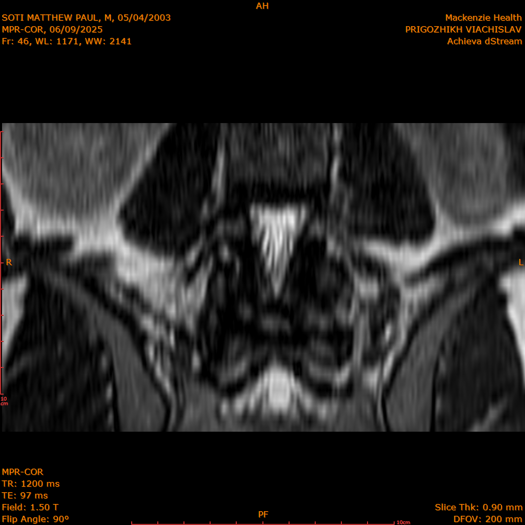 2025-06-09/MPR-COR/0047-IM108.png