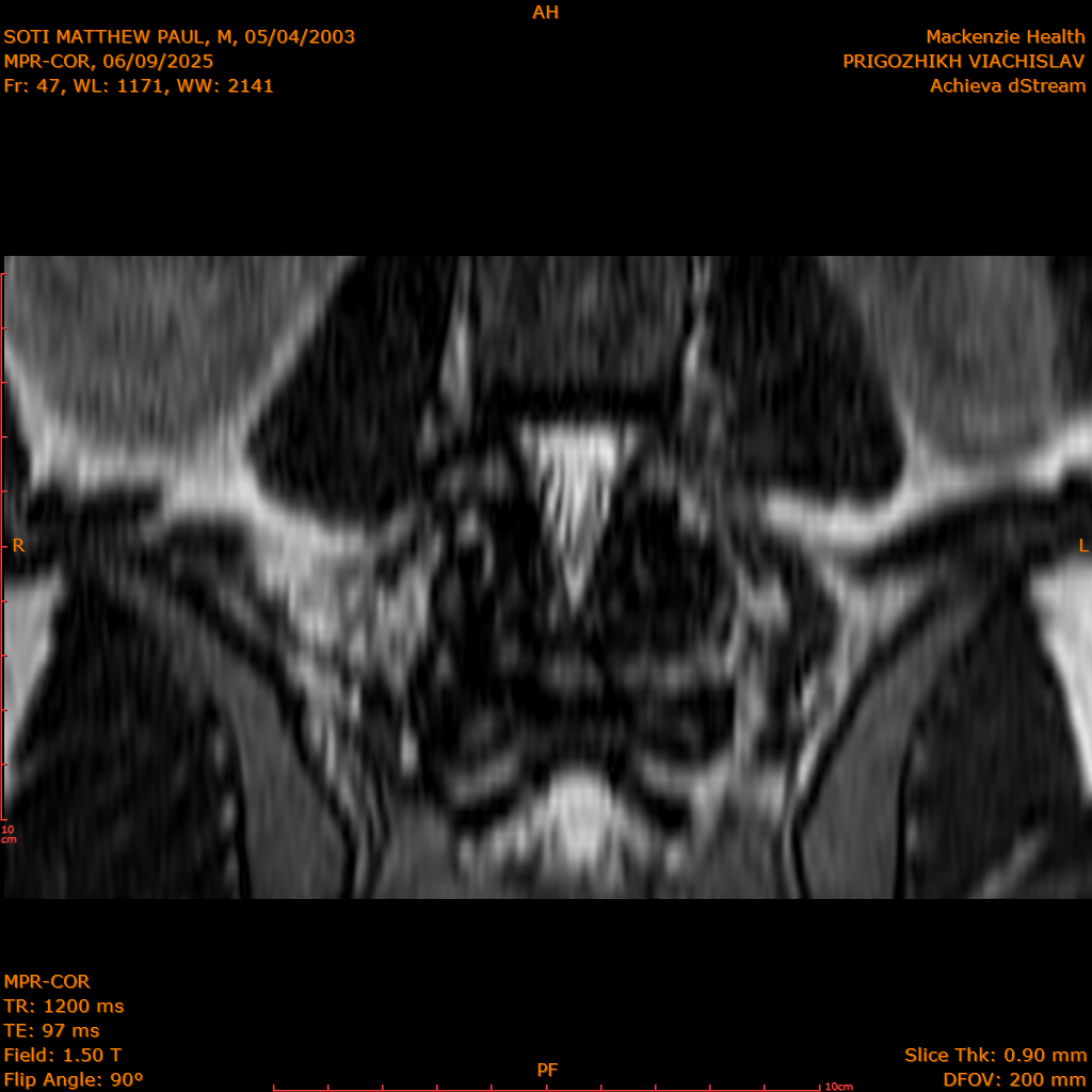 2025-06-09/MPR-COR/0048-IM109.png