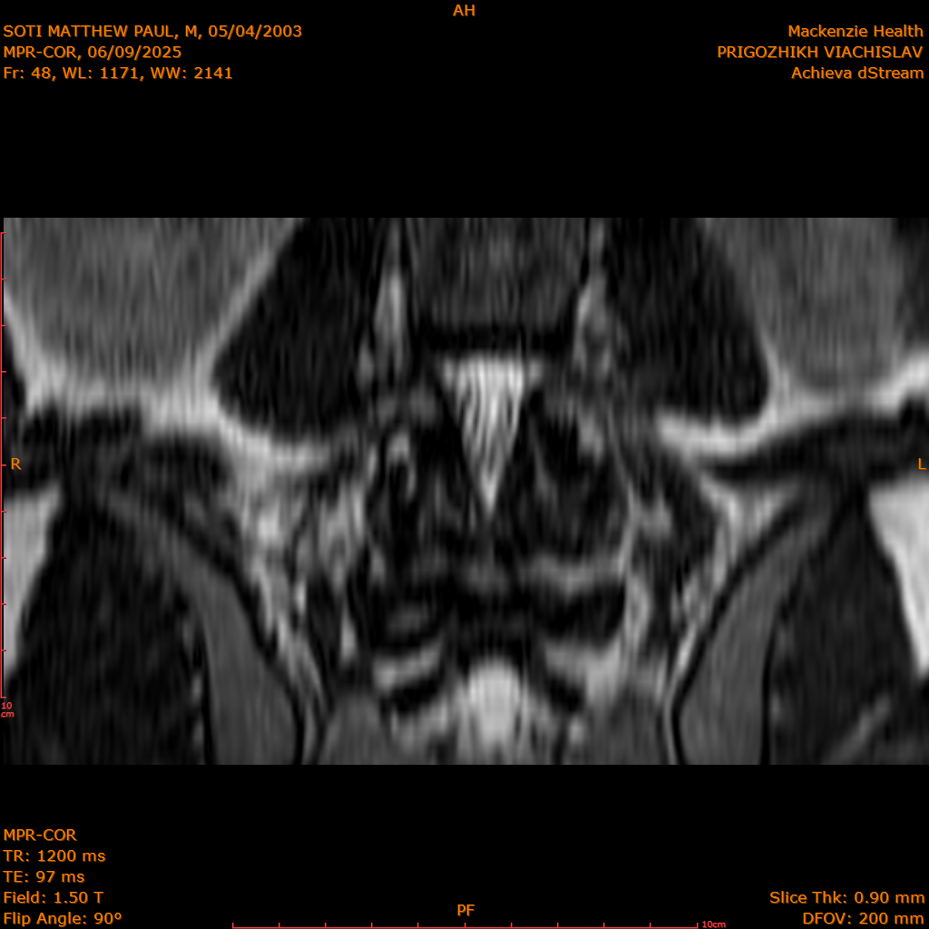 2025-06-09/MPR-COR/0049-IM110.png