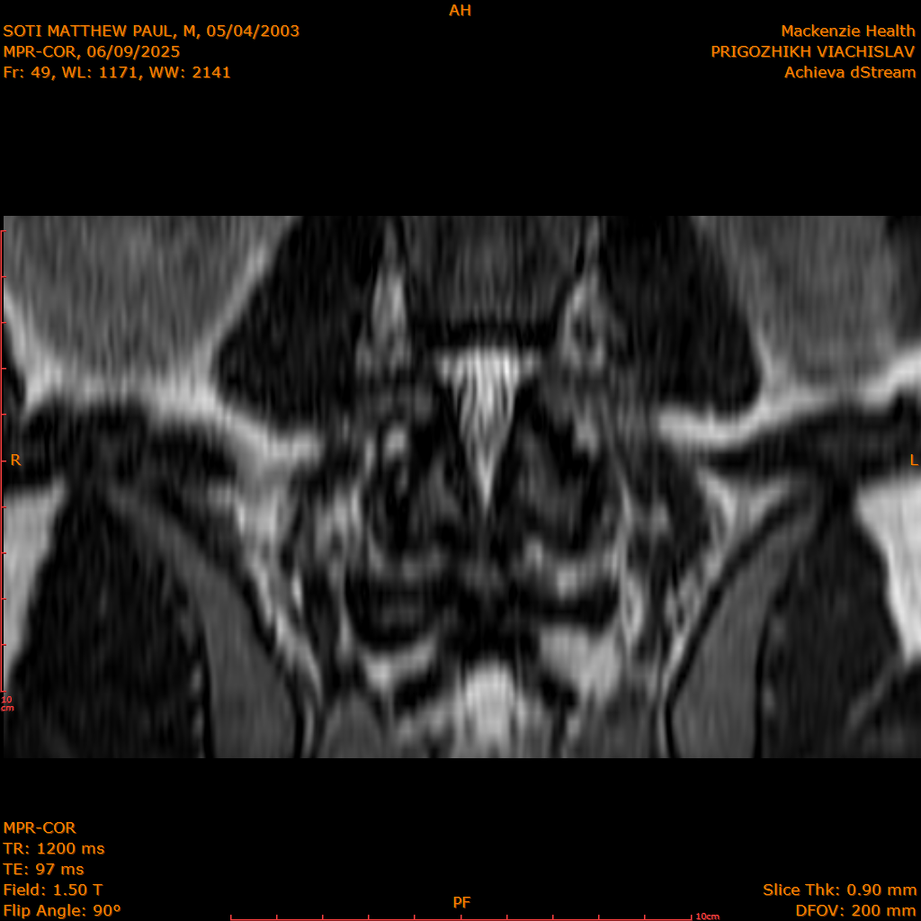 2025-06-09/MPR-COR/0050-IM111.png