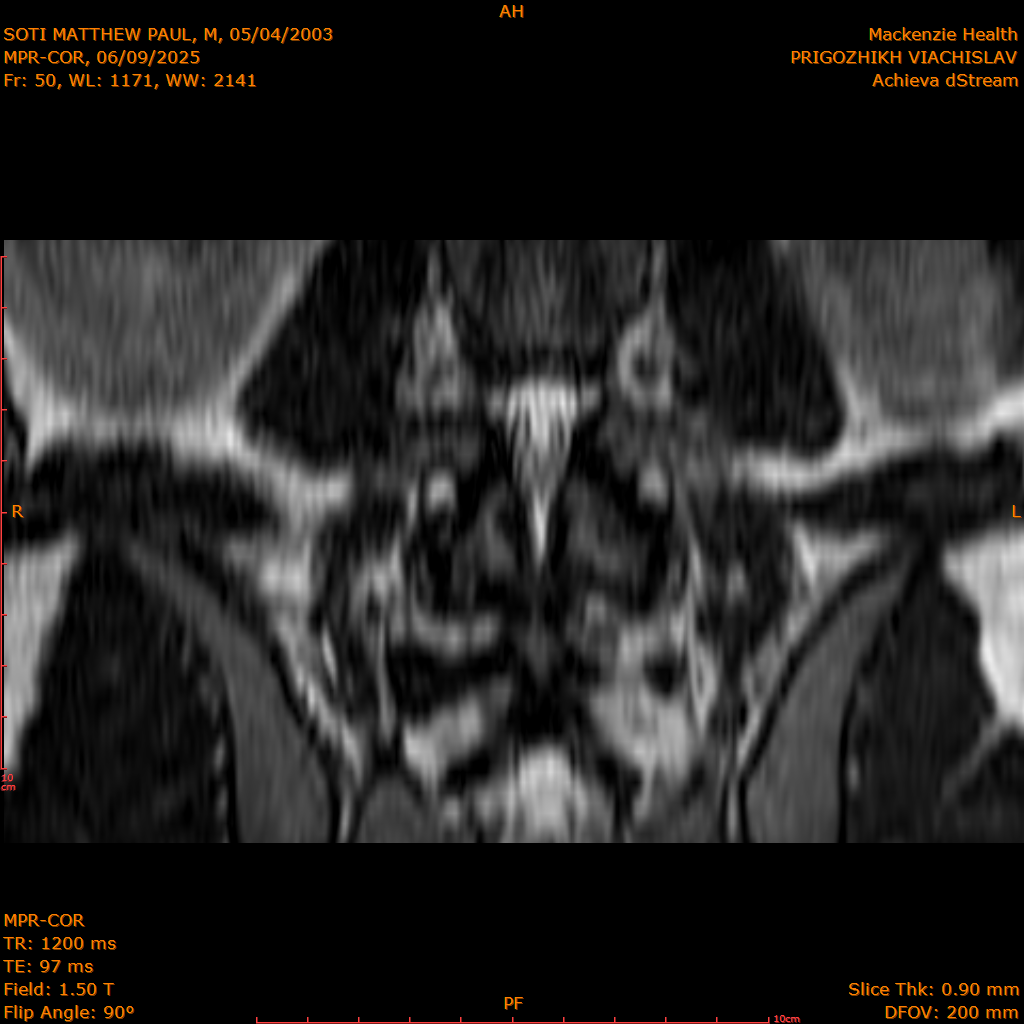 2025-06-09/MPR-COR/0051-IM112.png