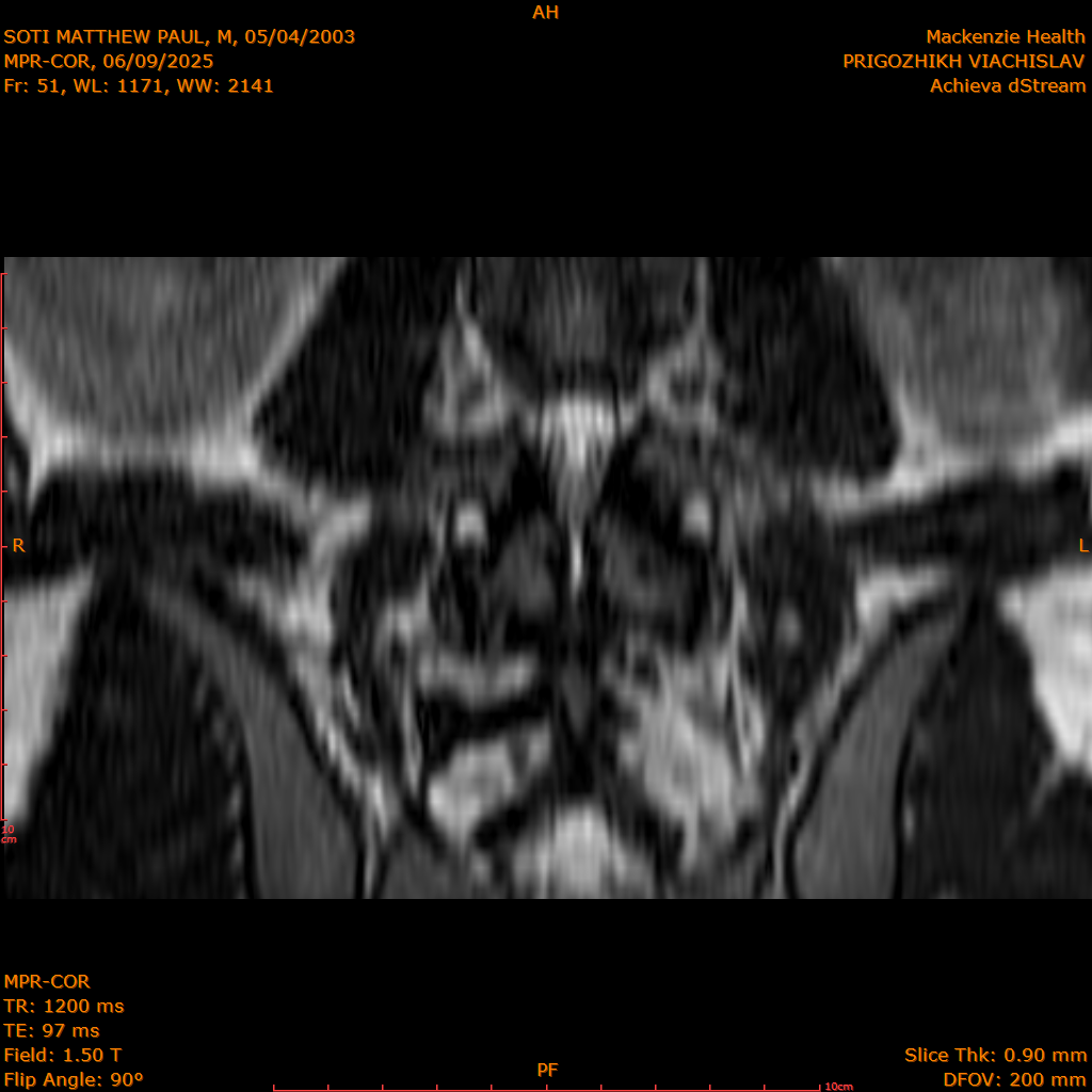 2025-06-09/MPR-COR/0052-IM113.png