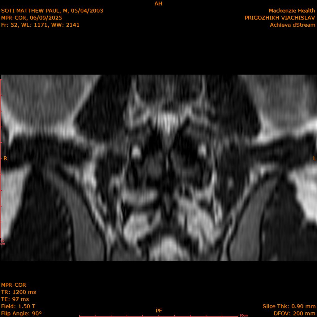 2025-06-09/MPR-COR/0053-IM114.png